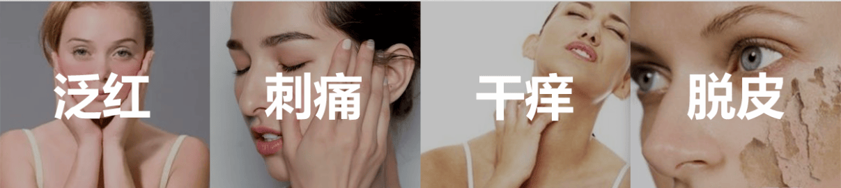 摩登季：专人专养定制护理，“娇贵”敏感肌的呵护专家