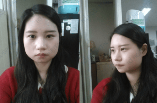 脸大怎么办？看看id的前后对比效果吧！ 