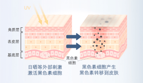 淡斑精华推荐丨遮瑕不如无瑕 