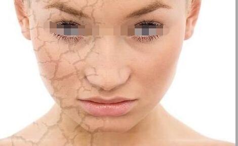 女人皮肤干燥掉皮如何补水这些方法补水效果最好 