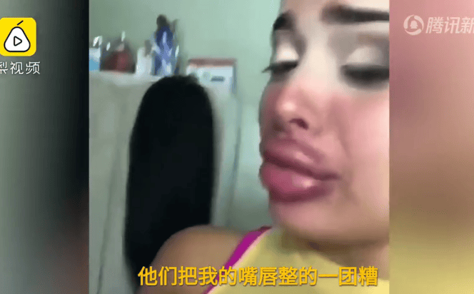 美女丰唇手术失败录视频哭诉“该咋办” 网友却笑疯(现场)
