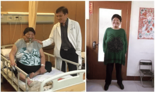 秀域集团总顾问黄致锟：减重手术为什么有效